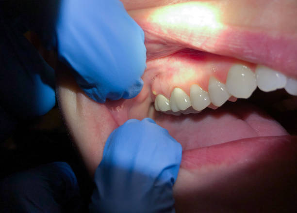 Best 24-Hour Emergency Dentist in Berryville, AR